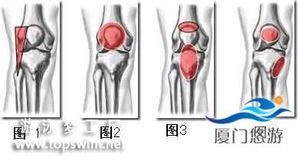 跑步膝盖疼痛的常见原因及科学应对方法