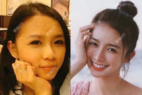 为什么一运动脸就爆红？科学解释与应对方法