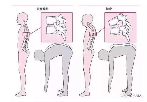 跑步能有效瘦腰腹和肚子吗?科学解析与实用建议